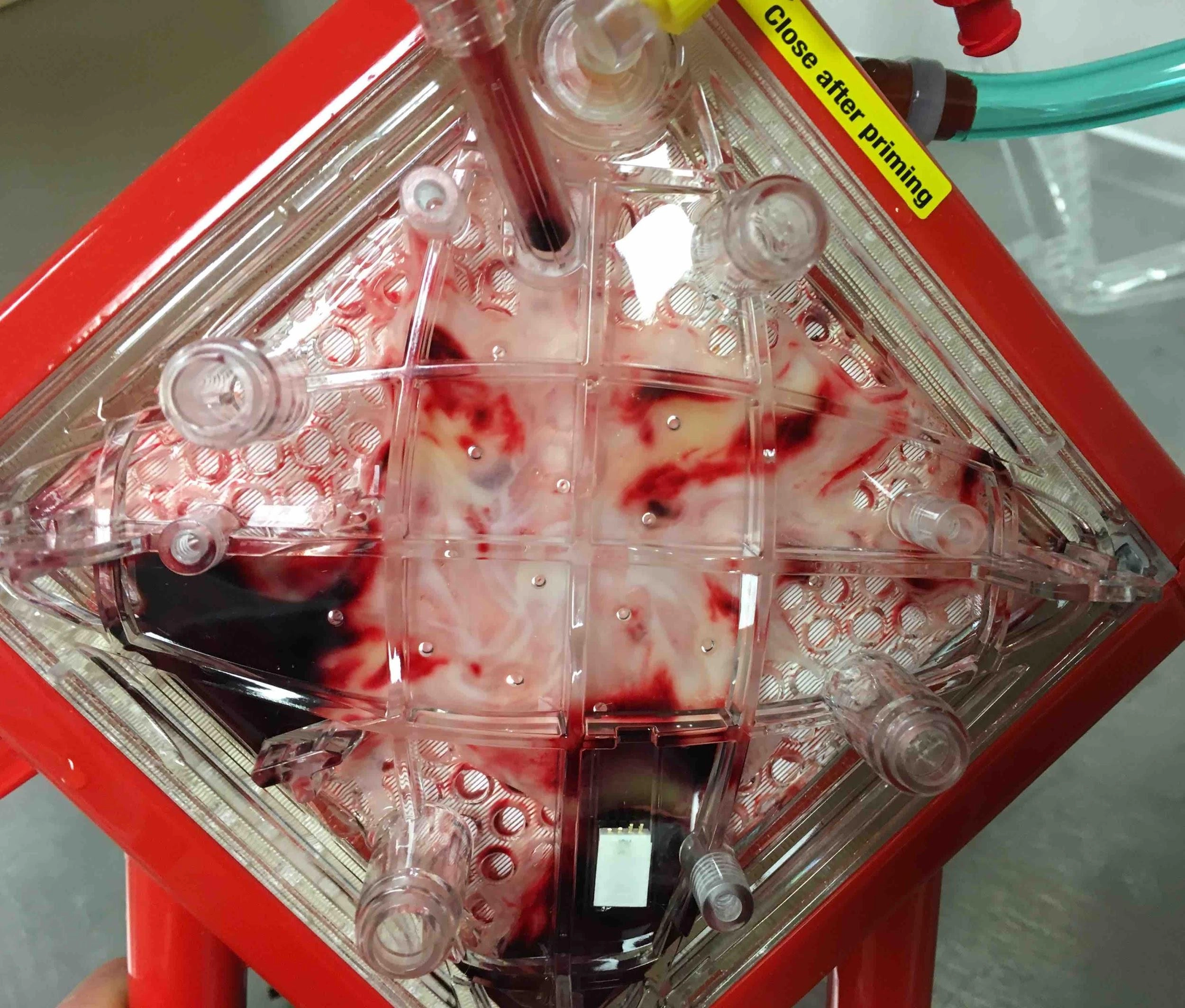 ecmo-guideline-img-5b800e00c49b2c3ccc74879aafa66b05dfc7a6a9